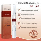 WartOff Hautflecken Entferner | Schmerzfrei | Natürliche Formel | 1+1 Gratis