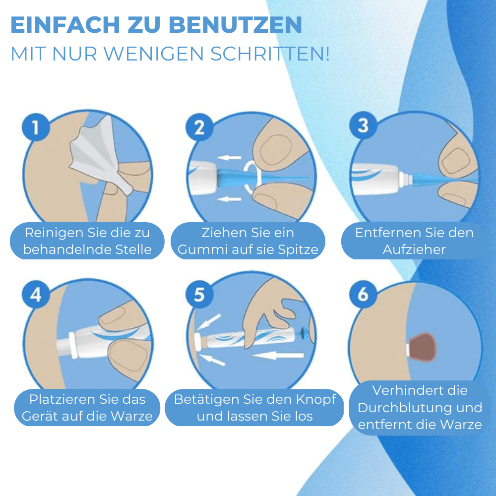 Warzen & Muttermale Entferner Set | Schmerzfrei | Schnelle Ergebnisse | Für alle Hauttypen