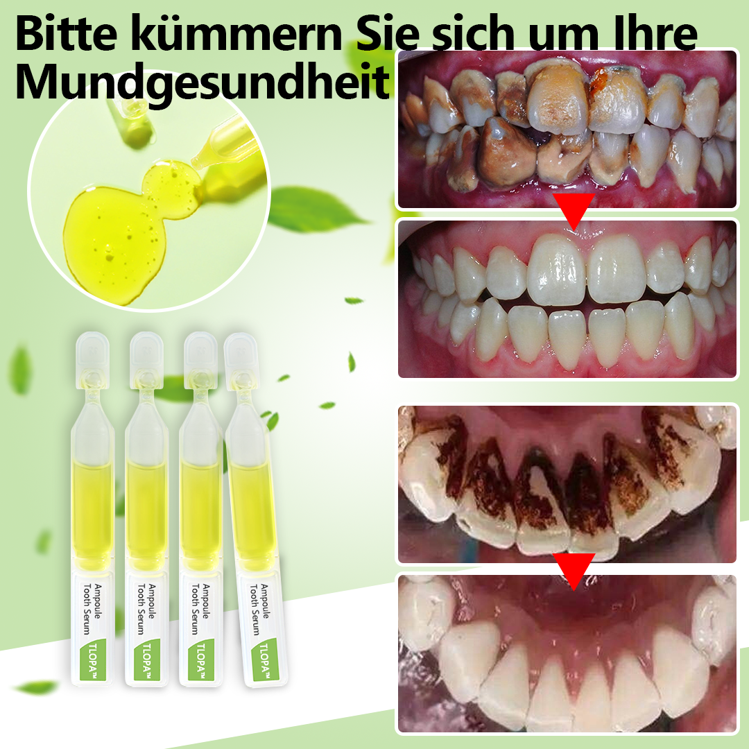 Zahnpasta Ampullen | Zahnstein Entfernung | Natürliche Inhaltsstoffe | Frischer Atem