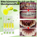 Zahnpasta Ampullen | Zahnstein Entfernung | Natürliche Inhaltsstoffe | Frischer Atem