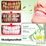 Zahnpasta Ampullen | Zahnstein Entfernung | Natürliche Inhaltsstoffe | Frischer Atem