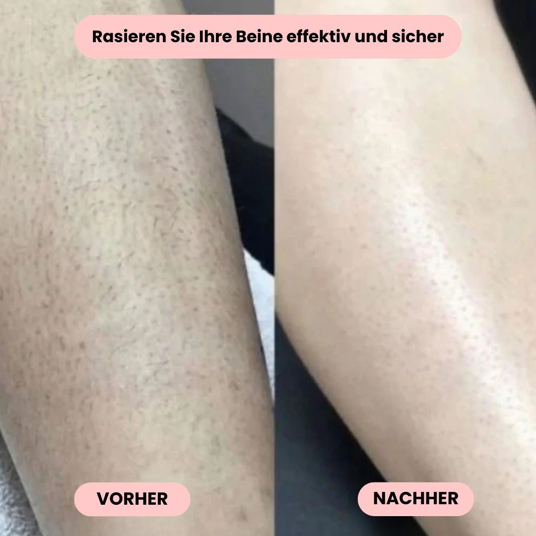 Intimrasierer Frauen | Elektrischer Rasierer für Damen | IntimLisse