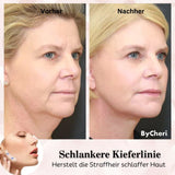 1 + 1 GRATIS HEUTE | 2025 Unsichtbares Facelifting-Band-Set™