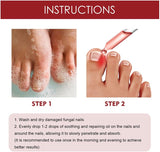 1+1 Gratis | HealNail™ Reparatur beschädigter Nägel in 4 Wochen