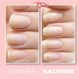 1+1 Gratis | NailWonder™ Stärken Sie schwache Nägel und verhindern Sie mühelos Bruch