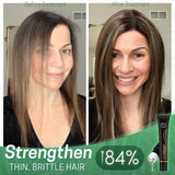 1+1 Gratis | NextGrow™ Stoppt Haarausfall schnell durch Förderung des natürlichen Haarwachstums