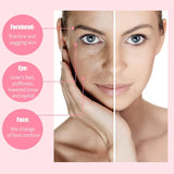 1+1 NUR HEUTE KOSTENLOS | SkinGel™- Anti Pores für glattere und straffere Haut!