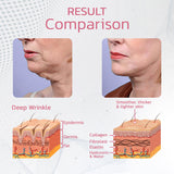 50% RABATT TEMPORÄR | Beautify™ - Säubern Sie Ihr Lymphsystem!