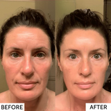 50% RABATT TEMPORÄR | RevitaMask™ | Genieße eine straffe & strahlende Haut!