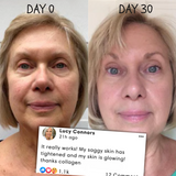 50% RABATT TEMPORÄR | RevitaMask™ | Genieße eine straffe & strahlende Haut!