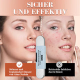 ClearSkin™ - Präzise Entfernung von Mitessern