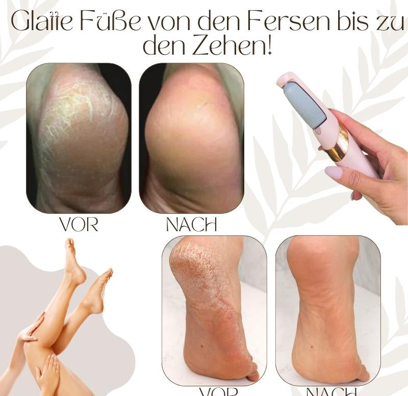 Elektrischer Hornhautentferner | Quarz-Kristallrollen | LED-Licht | Wasserdicht & Wiederaufladbar | CallusPro
