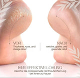 Elektrischer Hornhautentferner | Quarz-Kristallrollen | LED-Licht | Wasserdicht & Wiederaufladbar | CallusPro