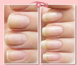 FavNail™ - Repair your broken nails