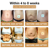 Fettverbrennungspflaster | Mit Bienengift & Kräuterextrakten | Stoffwechsel aktivierend | Natürlich & Effektiv (10er Set)