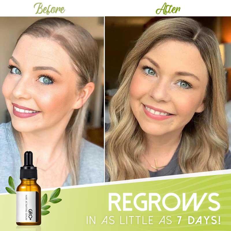 GRO+ HAIR SERUM™ | VOLLERES HAAR ERHALTEN