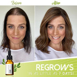 GRO+ HAIR SERUM™ | VOLLERES HAAR ERHALTEN