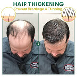 HairGrowth™ - Volleres Haar auf natürliche Weise