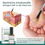 Hühneraugenentferner Gel | Extra Stark & Schmerzfrei | FootPro