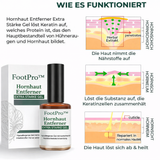 Hühneraugenentferner Gel | Extra Stark & Schmerzfrei | FootPro