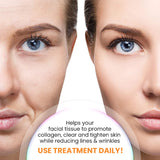 HydraLuxe™ | Koreanische Dermalayr-Technologie Löslicher Kollagenfilm