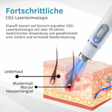Klara™ Schmerzfreier Laser-Stift — Enthülle jederzeit makellose Haut und Selbstvertrauen