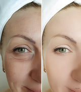 MagicSerum™ - Macht die Haut glatter und jünger