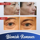 Miracle Cream™ - Erhalten Sie eine strahlende Haut