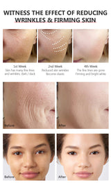 Retinol Anti-Aging-Serum