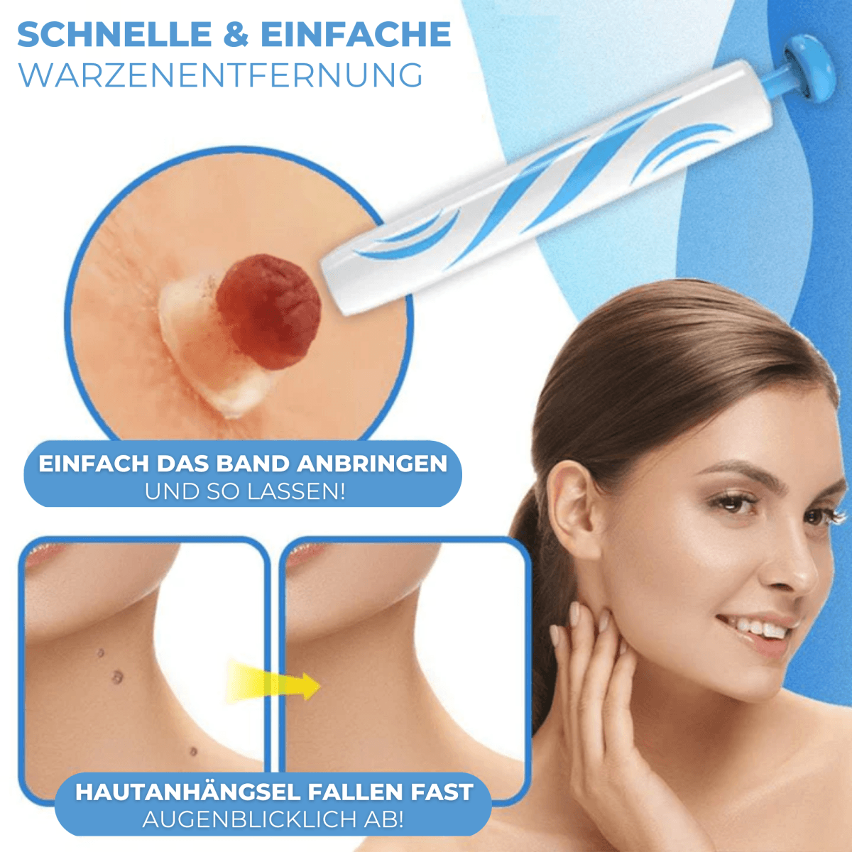 Warzen & Muttermale Entferner Set | Schmerzfrei | Schnelle Ergebnisse | Für alle Hauttypen