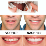 Zahnprothese zum Aufstecken | Einstellbare Passform | Natürliches Lächeln | Wiederverwendbar