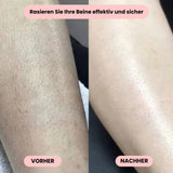 Intimrasierer Frauen | Elektrischer Rasierer für Damen | IntimLisse